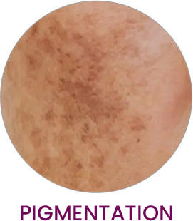 Asheera